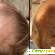 Средства против выпадения волос - Разное (красота и здоровье) - Фото 87142