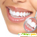 Профессиональная чистка зубов - Отбеливание зубов - Фото 78437