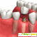 Зубные импланты -  - Фото 199952