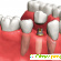 Имплантация зубов в спб отзывы -  - Фото 598725