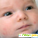 Красные пятна у новорожденного на затылке: виды, причины появления, консультация врача -  - Фото 674440