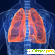 Бронхиальная астма у взрослых: симптомы, лечение, как начинается астма у взрослых -  - Фото 678437