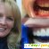 Виниры на зубы фото отзывы минусы и плюсы -  - Фото 677973