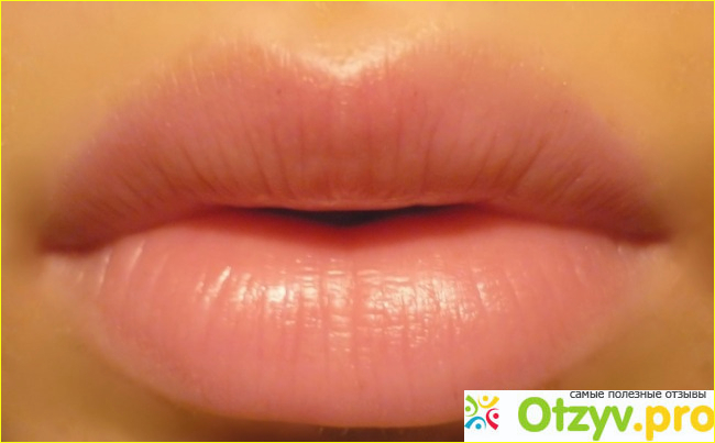 Отзыв о Гиалуроновая кислота губы