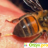 Польза от укуса пчелы отзывы
