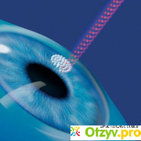 Лазерная коррекция зрения - операция отзывы