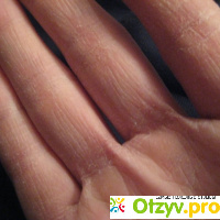 Как ухаживать за сухой кожей рук отзывы