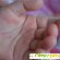 Сыпь на ладошках и ступнях у ребенка -  - Фото 403636