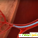 Эмболизация маточных артерий отзывы отрицательные -  - Фото 506713