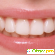 Гель стоматологический Метрогил Дента -  - Фото 659581
