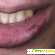 Почему синеют губы у взрослого человека: причины и лечение -  - Фото 723210