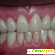 Отзывы о врачах стоматологах -  - Фото 800531