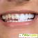 Виниры на зубы отзывы -  - Фото 860849