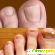 Лечение грибка ногтей на ногах препараты отзывы -  - Фото 963793