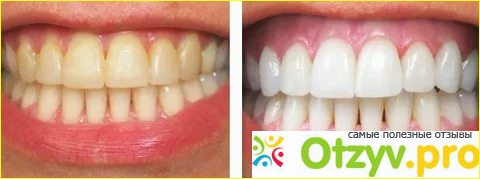 Что говорят специалисты про Окси для зубов: отзывы врачей