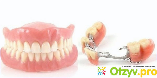 Отзыв о Какие съемные зубные протезы лучше поставить отзывы