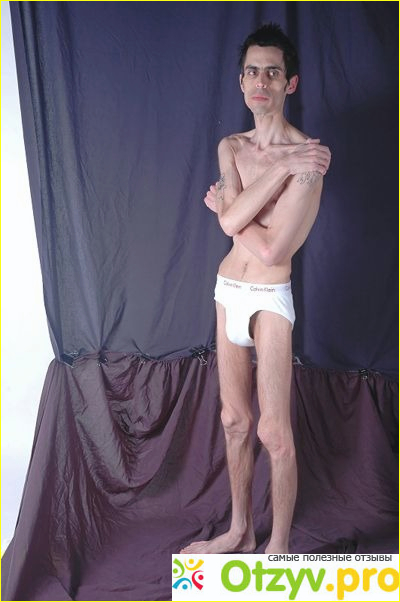 Самые худые люди в мире фото2
