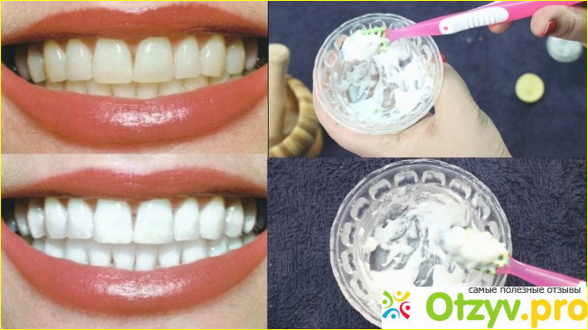 Отбеливающие полоски для зубов Aliexpress Advanced Teeth Whitening.