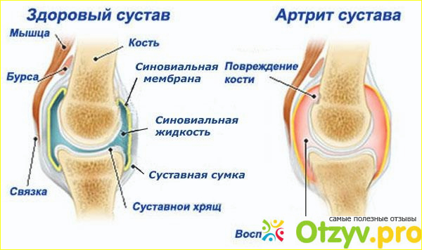 Как облегчить боль в коленном суставе 