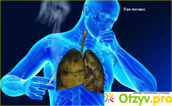 Бризантин - средство для борьбы с курением