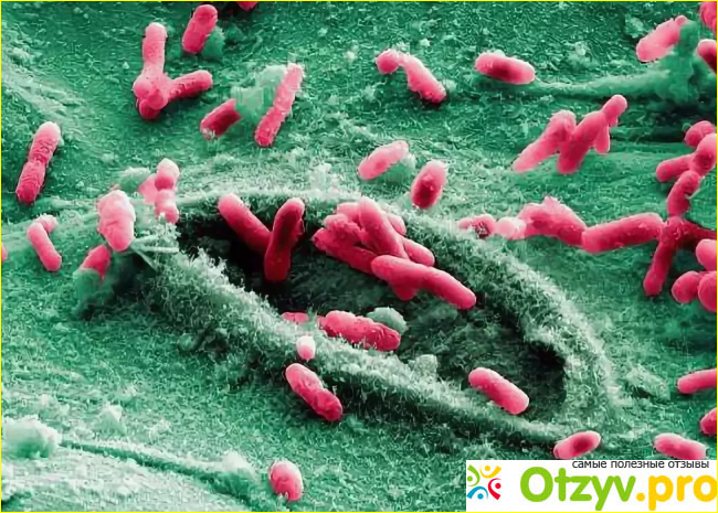 E. coli лактозонегативные у мужчин.