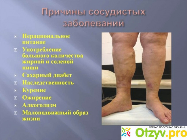 Профилактика заболеваний ног