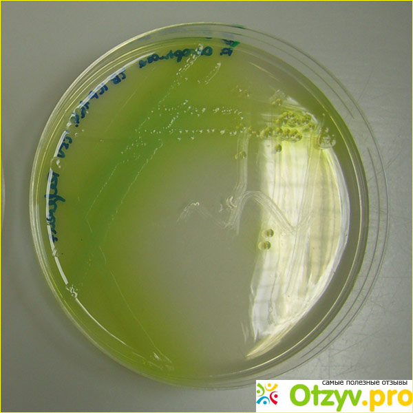 Цетримидный агар как микробиологическая питательная среда и его особенности фото1